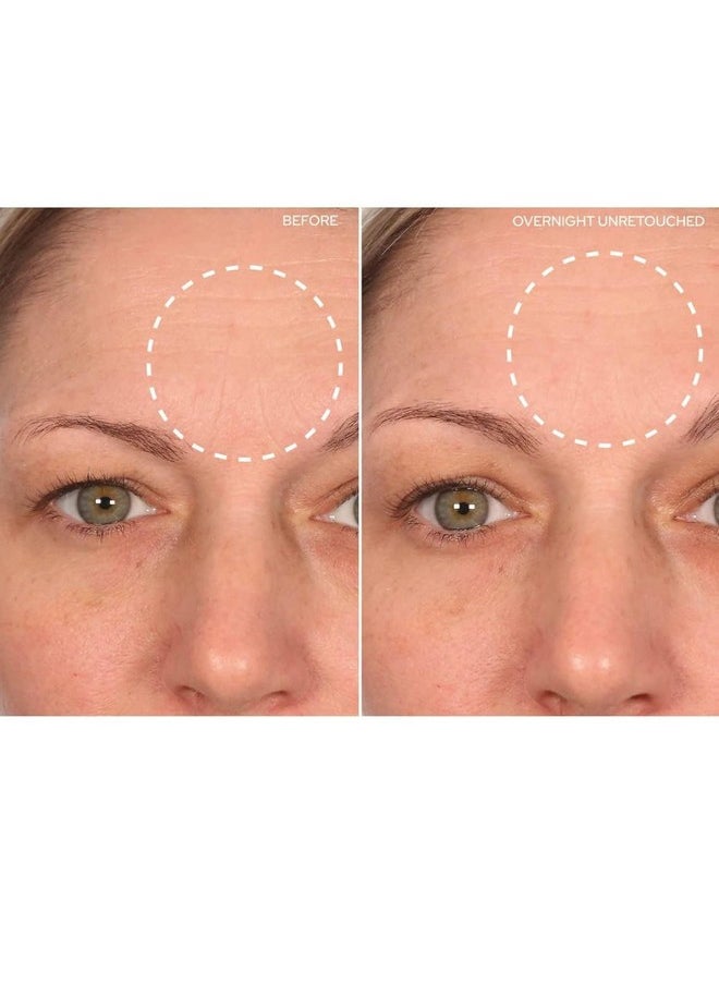 Sio Sio Beauty Browlift Forehead Antiwrinkle Patch Rapid Overnight Reusable Silicone Patch To Reduce Furrows Expression Lines And Creases  - Image 4