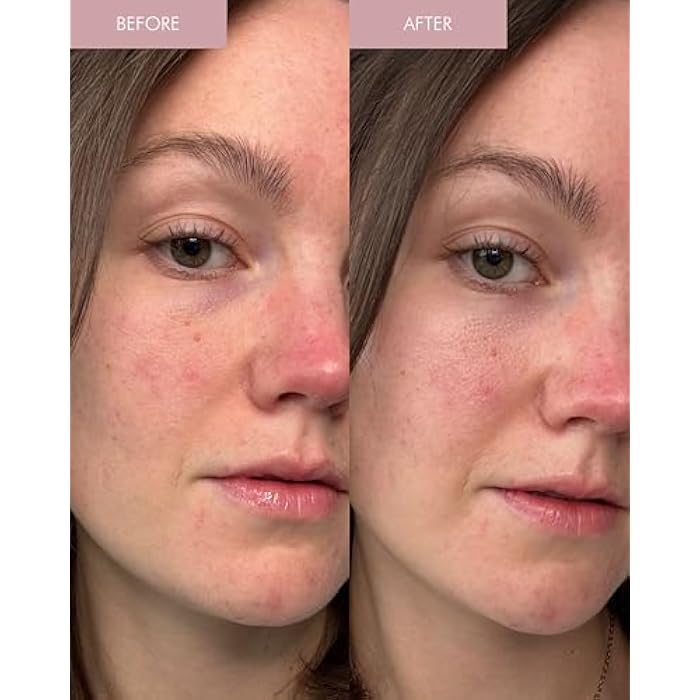 MARA - Pearl Peptide Glaze 3-in-1 Essence Toner Serum for Hydration & Redness | Prep Step to Plump + Hydrate Skin, For All Skin Types (3.38 fl oz | 100 ml) - Image 5