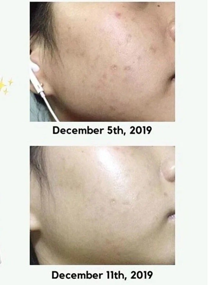 AXIS-Y Access Way Dark Spot Correcting & Brightening Serum 50ml - Image 2