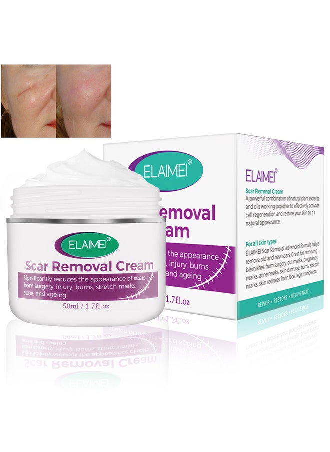Elaimei Scar Removal Cream, Advanced Scar Gel For Surgical And Acne Scars, Cuts, Burns, Helps With Old And New Scars, Natural Scar Treatment For Face And Body 50ML  - Image 1