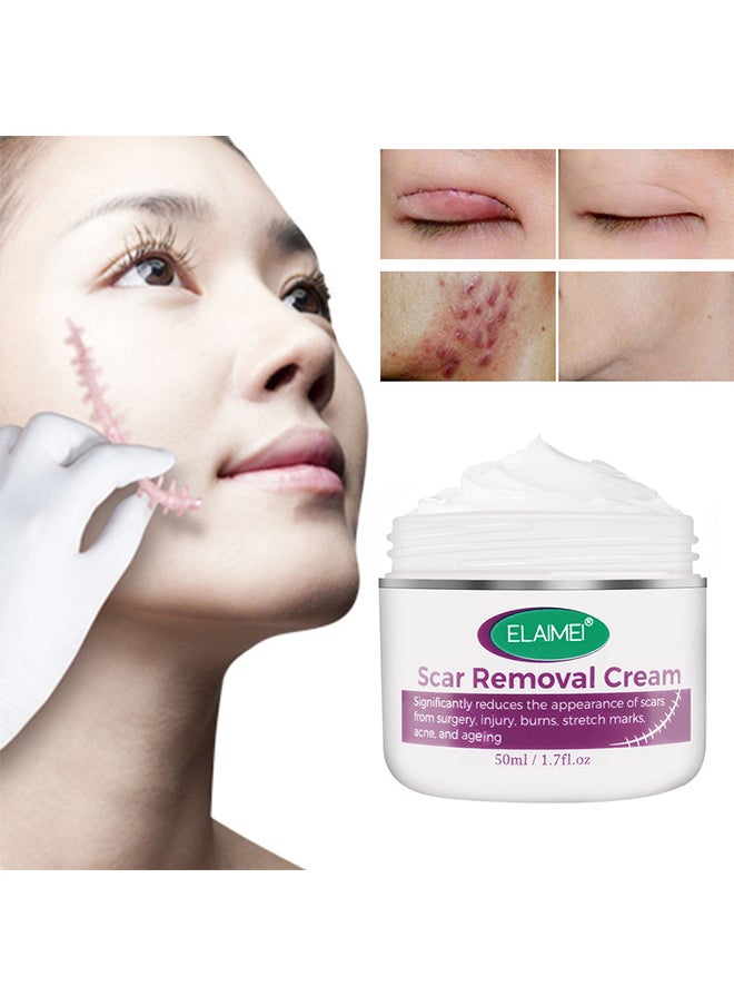 Elaimei Scar Removal Cream, Advanced Scar Gel For Surgical And Acne Scars, Cuts, Burns, Helps With Old And New Scars, Natural Scar Treatment For Face And Body 50ML  - Image 5