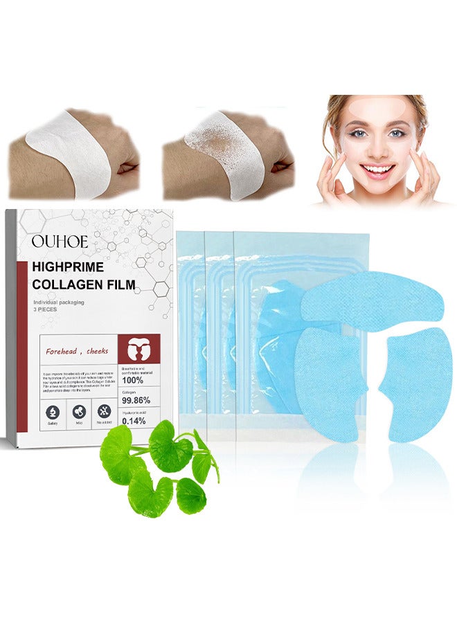 OUHOE Face Lifting Water Soluble High Prime Silk Collagen Film Hydrolyzed Collagen Face Film Sheet Anti Wrinkles Face Moisturizer Film Sheets, Prevent Fine Lines And Protect Skin, Anti Aging Face Mask - Image 1