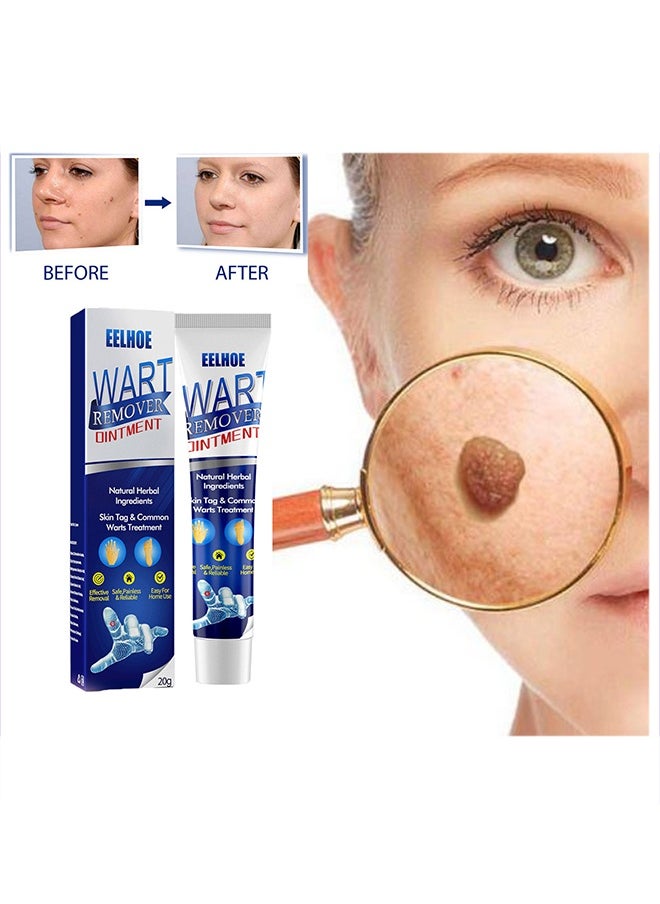 EELHOE Wart Removal - Natural Herbal Wart Remover Treatment Skin Repair Cream Against Moles Warts Use On Any Parts Of Body 20g  - Image 1