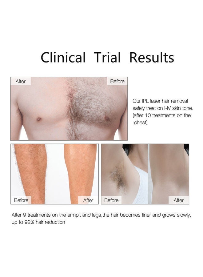 general جهاز إزالة الشعر بالليزر IPL المحمول أبيض 16.9 × 7.3 × 4.7 سم - Image 4