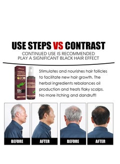 SOUTH MOON 100ml Herbal Hair Repair Spray，Polygonum Multiflorum And Ginger Black Hair Liquid, Herbal Extracts Nourish And Repair Gray Hair  - Image 3