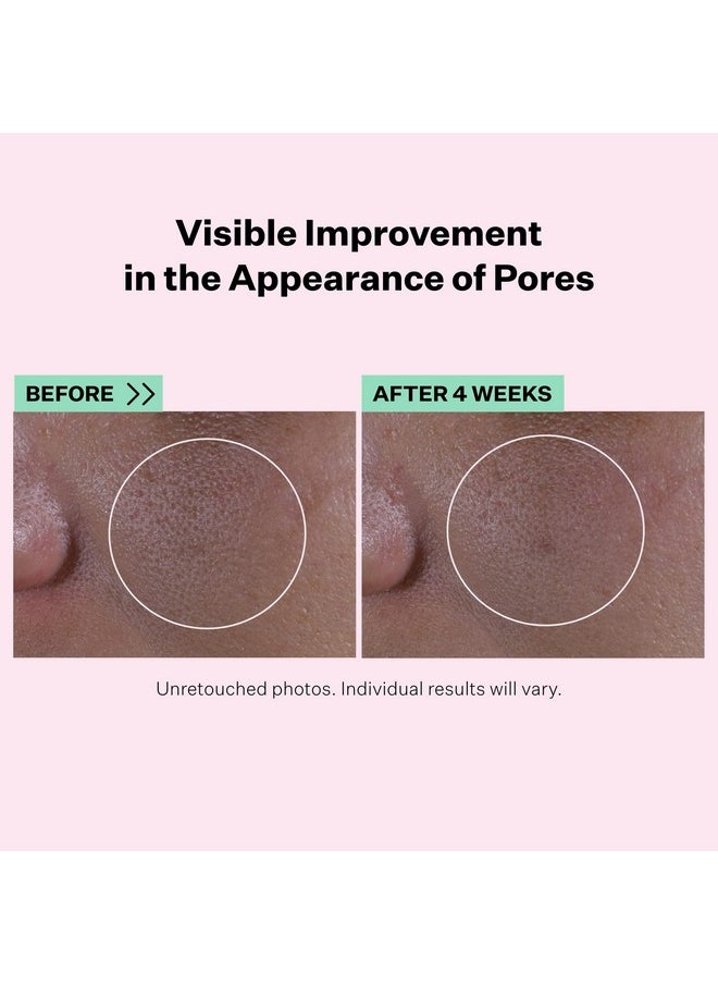 Strivectin - Multiaction Super Shrink Pore Minimizing Serum For Minimizing Clogged Pores And Blackheads For Tightening And Brightening Skin Texture - Image 1