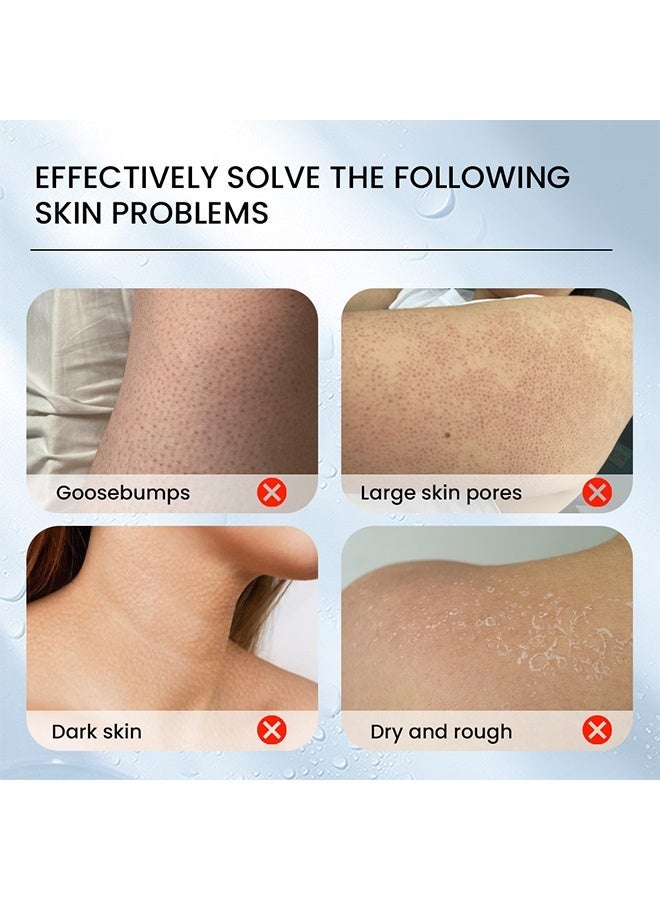 Sumifun Keratosis Pilaris Repair Cream 30g, Vitamin E Cream, Chicken Skin Cream Urea Exfoliates Lumps - Image 3