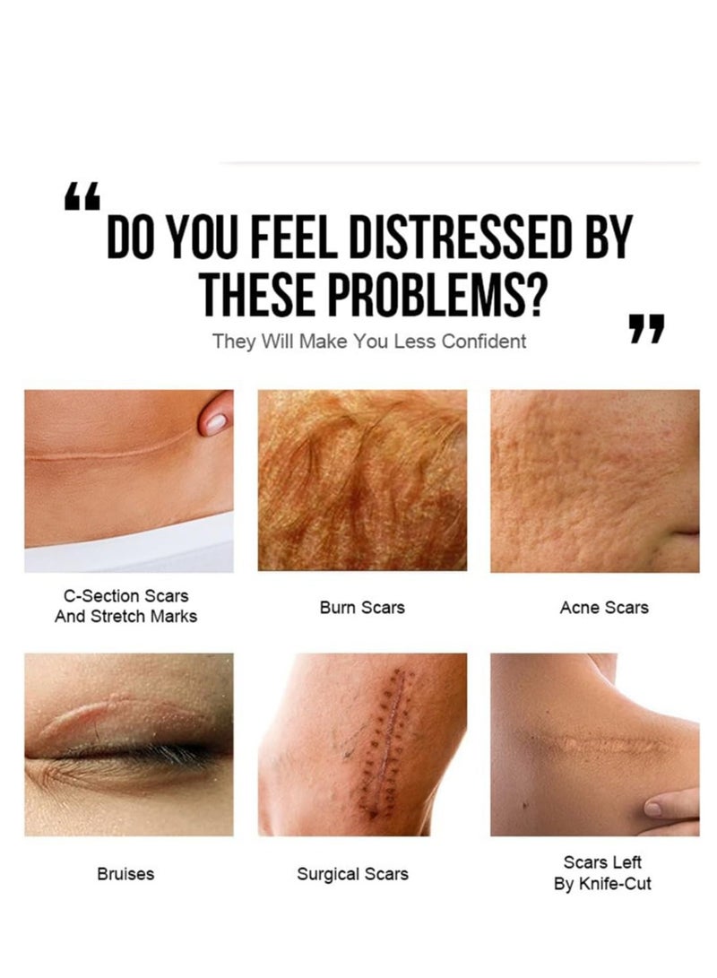 JoyPretty Shea Butter Intensive ,Scar Reducing Treatment, Intensive Repairing Scar Cream from Burns, Surgery 40g - Image 2