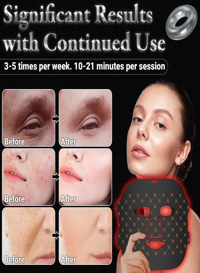 ANSIOVON Red Light Therapy Mask for Face - Image 3
