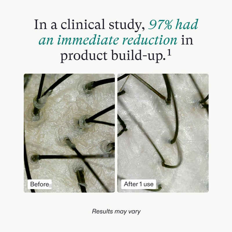 Nutrafol Exfoliating Scalp Mask, Eliminates Product Build-up and Oil for Healthier Hair and Scalp, Physician-formulated for Thinning Hair, Color and Extension Safe - 4 Fl Oz Bottle - Image 4