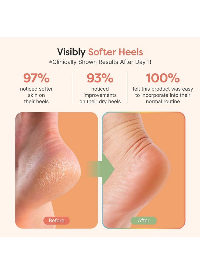 Zentoes ZenToes Moisturizing Sleep Socks with Vitamin E, Olive Oil and Jojoba Seed Oil to Soften and Hydrate Dry Cracked Heels (Fuzzy Pink, Regular)  - Image 4