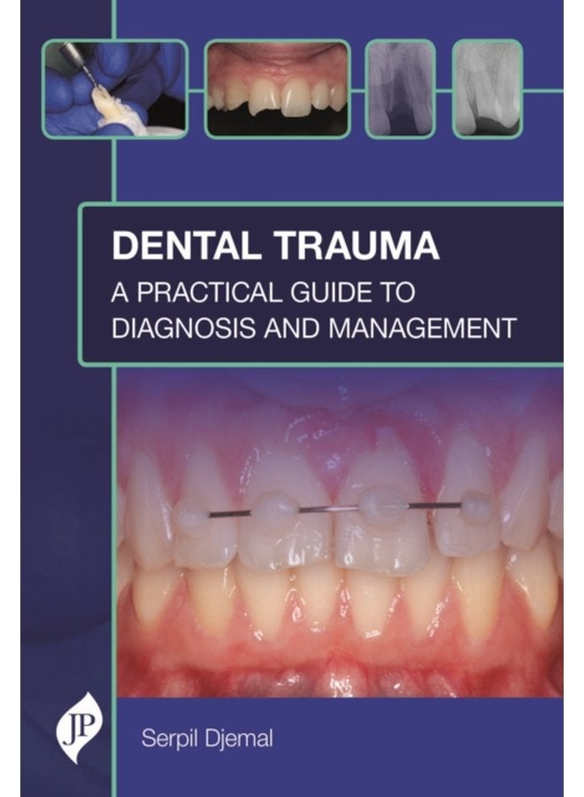 Dental Trauma A Practical Guide to Diagnosis and Management - Hardback