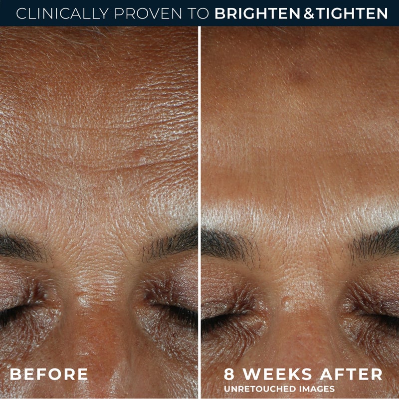 RoC سيروم فيتامين سي للوجه من RoC 10% - مضاد للشيخوخة، وموحد لون البشرة، وعلاج البقع الداكنة - Image 4