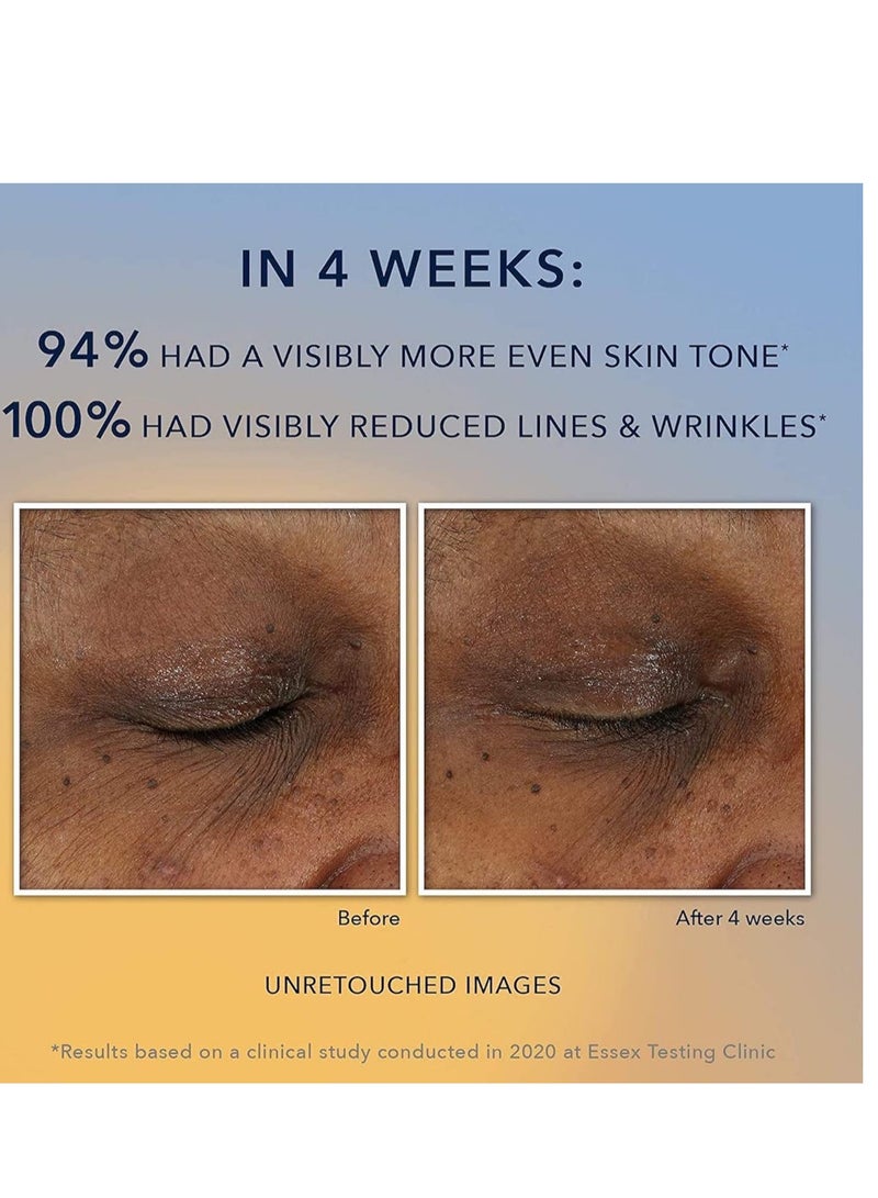 RoC 10% Vitamin C Face Serum - Anti-Aging, Skin Tone & Dark Spot Treatment