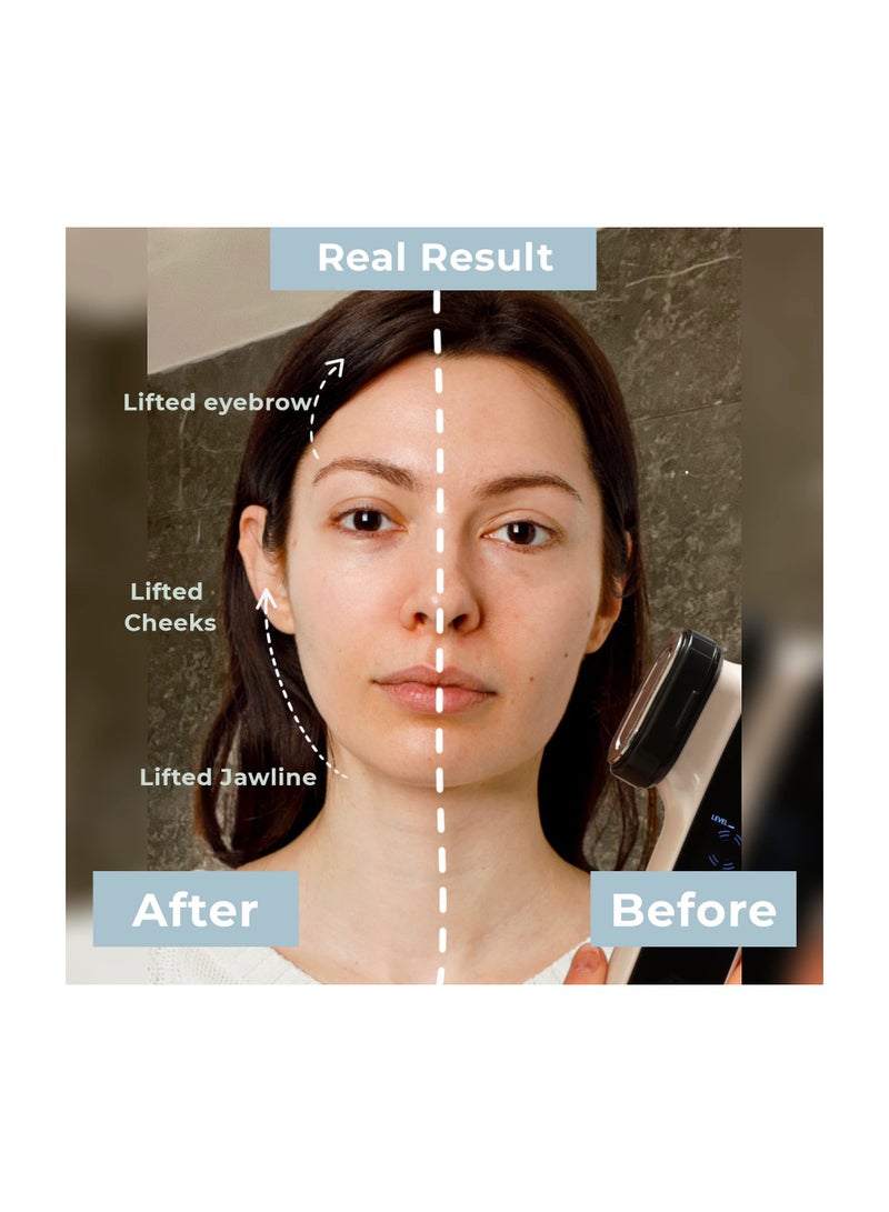 Zikra Suntown Radio Frequency Skin Tightening Machine,6-in-1 Rechargeable Anti-Aging Skin Care Microcurrent Facial Device, Red Light, Wrinkle Remove, Rejuvenation, Skin-Firming, Coal Black and Pearl White - Image 4