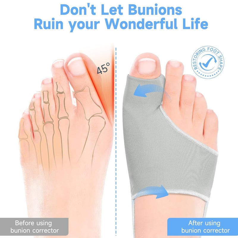 Bunion Corrector for Women & Men - Toe Separators and Hammer Toe Straightener for Hallux Valgus Pain Relief - Image 2