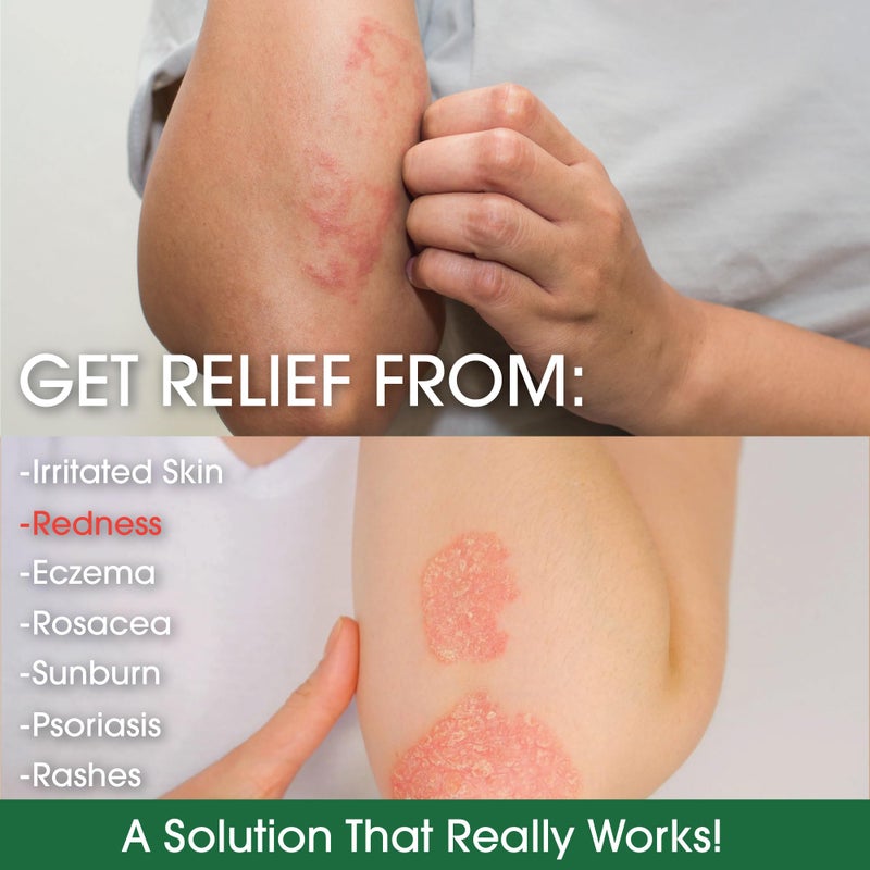 Green Leaf Naturals - Manuka Honey Face Cream - 8oz -Aloe Vera - Jojoba Oil Infused - Body Cream - Gluten Free Moisturizer for Kids & Adults - Nourishing Skin Care - Image 4