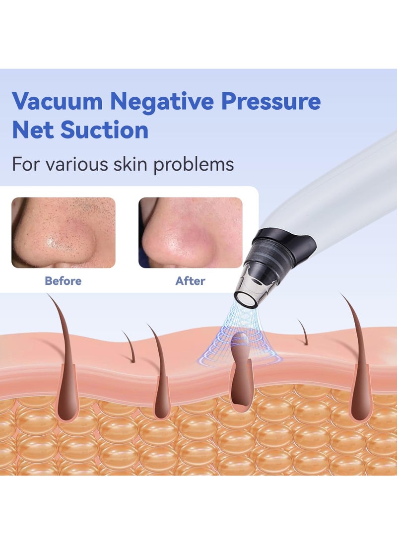 Blackhead Remover Pore Vacuum, Face Vacuum Pore Cleanser, Electric Acne Comedone Whitehead Remover Tools 4 Suction Power with LED Display, Rechargeable Pimple Popper Tool Kit