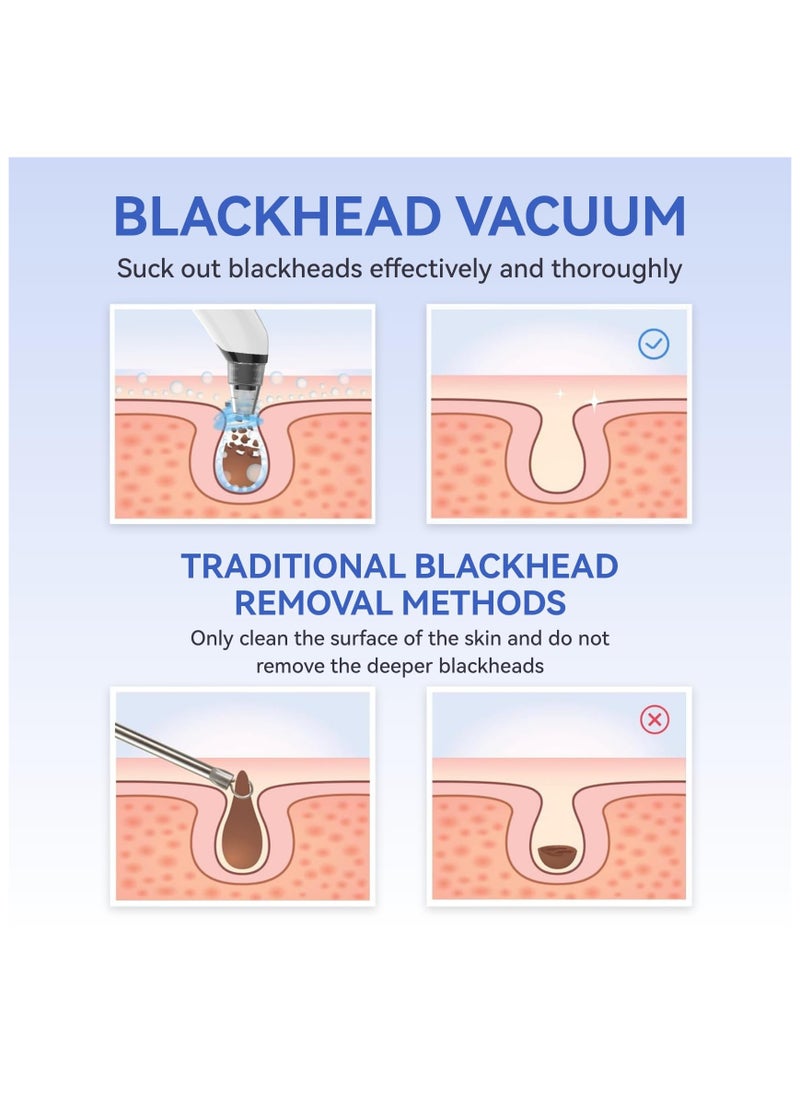 Blackhead Remover Pore Vacuum, Face Vacuum Pore Cleanser, Electric Acne Comedone Whitehead Remover Tools 4 Suction Power with LED Display, Rechargeable Pimple Popper Tool Kit