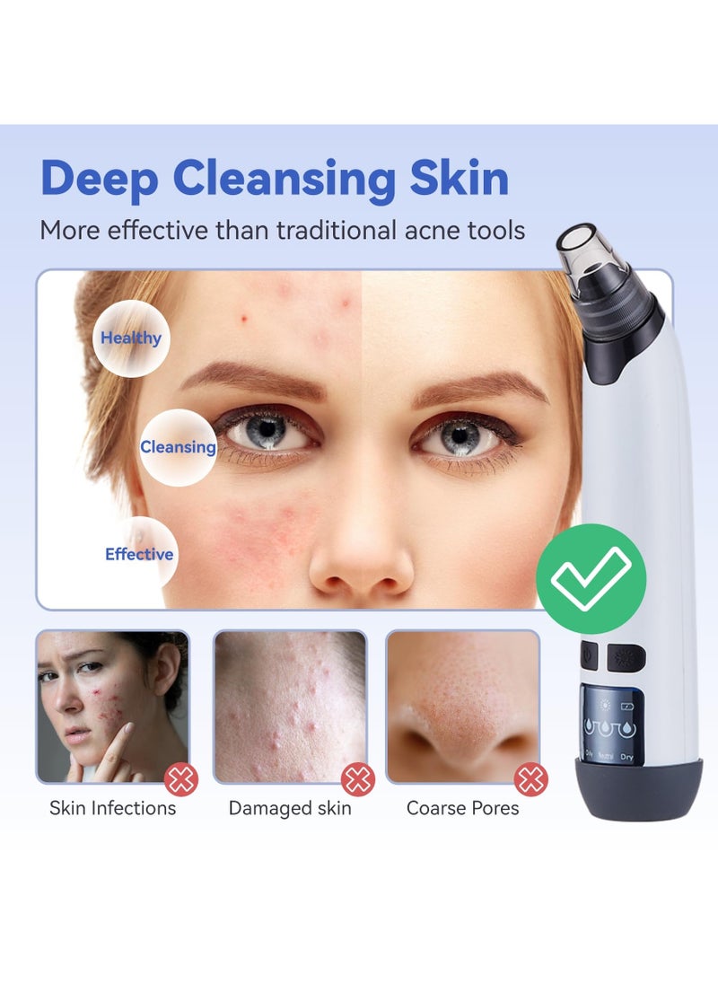 Blackhead Remover Pore Vacuum, Face Vacuum Pore Cleanser, Electric Acne Comedone Whitehead Remover Tools 4 Suction Power with LED Display, Rechargeable Pimple Popper Tool Kit