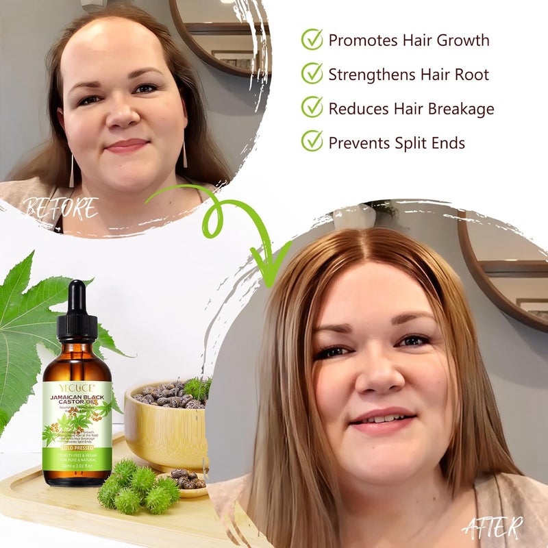 Yecuce Organic Pure Natural Castor Oil for Hair Growth, Eyelash and Eyebrow Growth, Scalp Nourishing, Dry Skin Relief, 100% Pure Cold Pressed Black Castor Oil 60ml. - Image 4