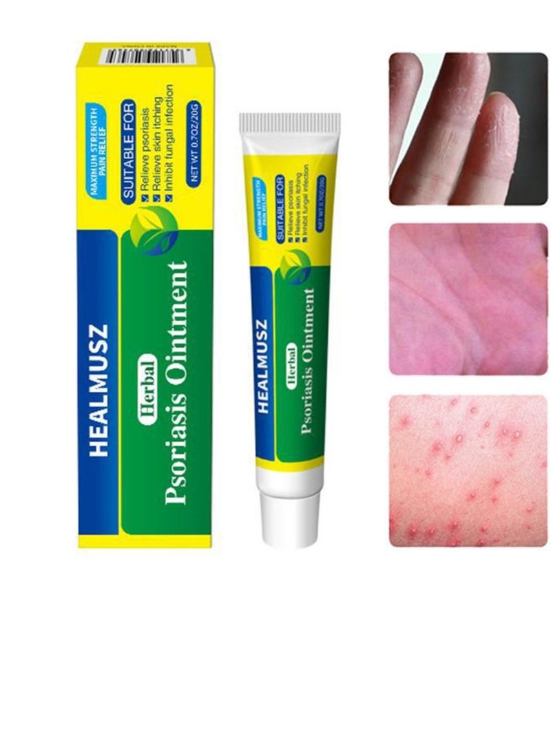 هيلموسز مرهم عشبي لعلاج الصدفية والسعفة، ٢٠ غرام - تخفيف سريع للحكة، قوة طبيعية إضافية للبشرة الجافة/المغبرة (للجنسين)