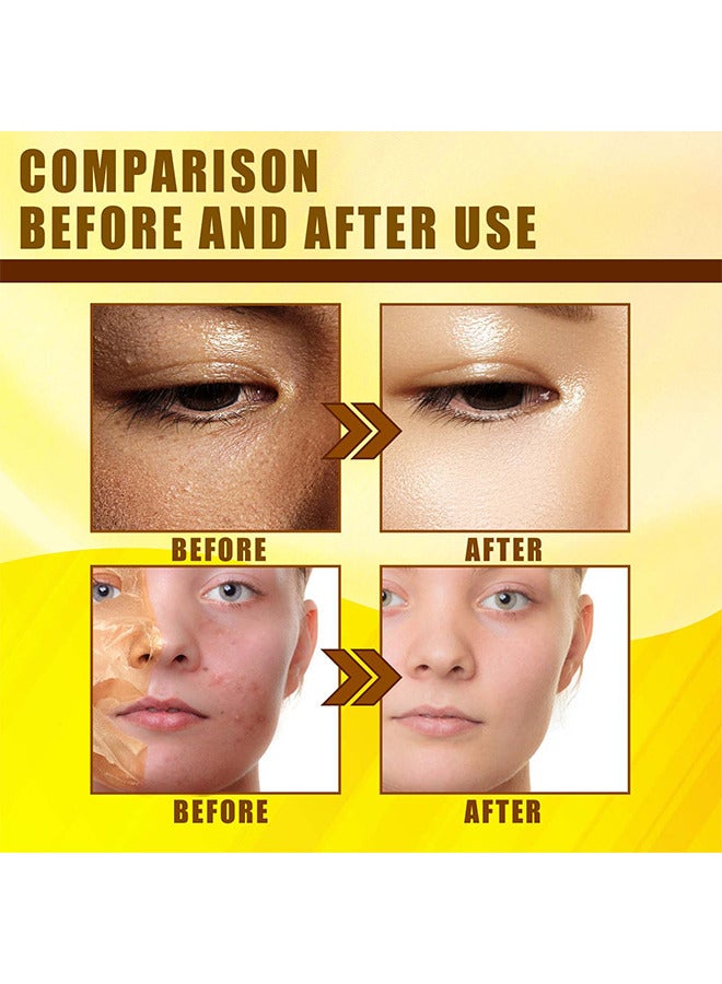 Jaysuing Yellow Peeling Oil 30ML Super Strength Dead Skin Remover Skin Moisturizing Hydrating Butter Peeling Remove Dead Skin And Calluses On Feet And Hand Dark Spot Peeling Oil - Image 5