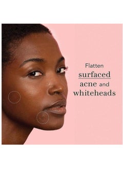 CARVENCHY 96 Pieces Miracle Patches Pimple Patches for Face Miracle Invisible Spot Cover Hydrocolloid Acne Blemishes and Zits Absorbing Patch Breakouts Treatment for Skin Care Facial Stickers  - Image 4