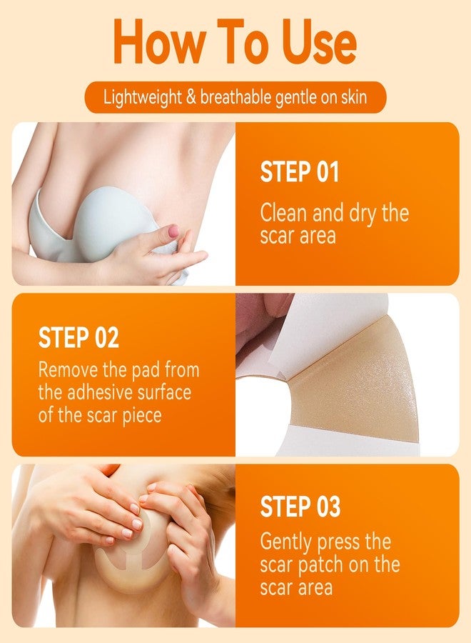 Nubical Silicone Scar Sheets for Breast - Including 8 Areola Soft Strips & 4 Anchor Sheets, Medical Grade & Reusable Breast Silicone Scar Tape for Surgical Scars (Yellow) - Image 3