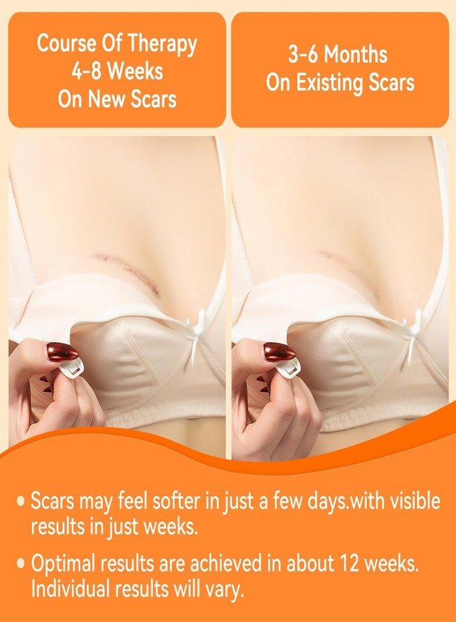 Nubical Silicone Scar Sheets for Breast - Including 8 Areola Soft Strips & 4 Anchor Sheets, Medical Grade & Reusable Breast Silicone Scar Tape for Surgical Scars (Yellow) - Image 5