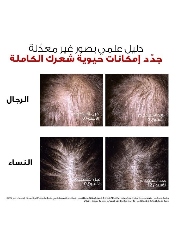 فيشي ديركوس أمينيكسيل كلينيكال ريجن بوستر سيروم مصمم خصيصاً لتقليل تساقط الشعر 90ملليلتر - Image 5
