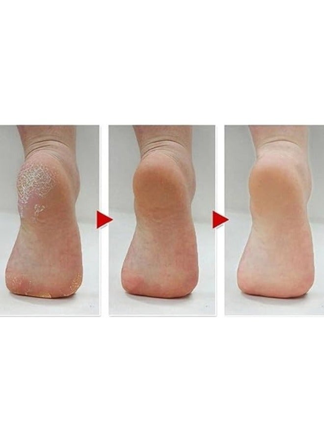 Professional Callus Remover and Dead Skin Peeling Tool with 3 Sharp Blades – Thick Hard Skin and Heel Callus Shaver for Removing Dead Layers, Cracked Feet, Rough Skin and Built-Up Calluses – Foot Hard Skin Remover with Built-In Rasp File for Smoothing Feet – Safe and Effective Foot Care Tool for Men and Women to Remove Tough Callus, Dry Skin and Heel Hardness with Easy Grip Handle for At-Home Pedicure Treatment - Image 2