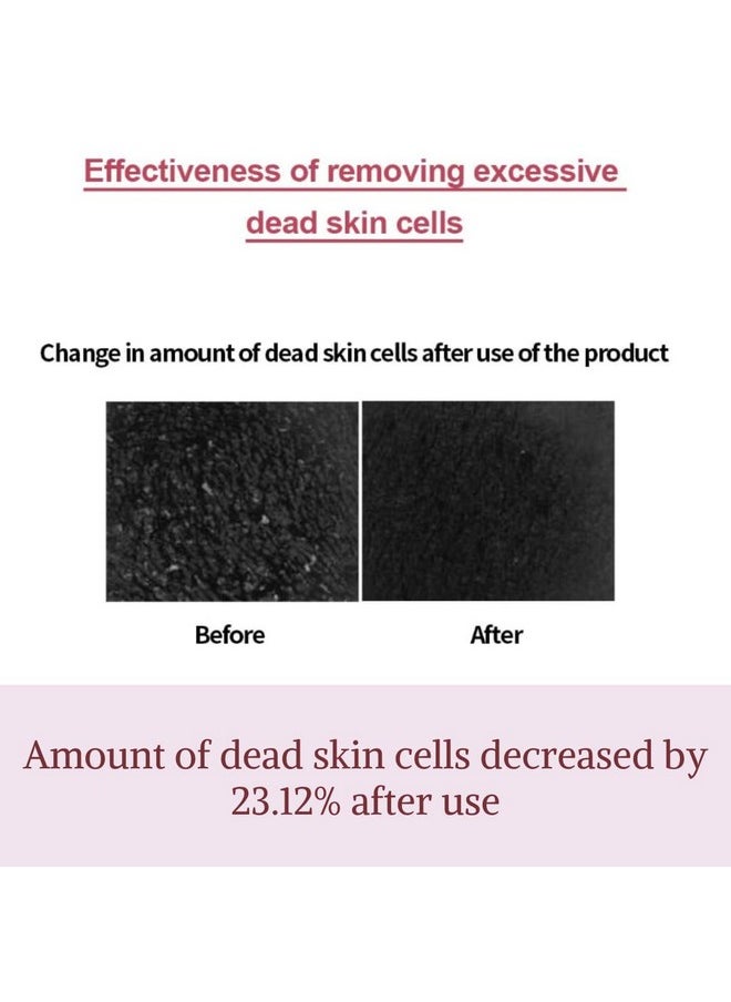 I'M FROM M] Fig Boosting Essence 150Ml Lightweight Hydration With Bha Nmf Peptide And Polyphenol For Smooth Skin Prep Full Hydration And Antiaging Effects  - Image 4