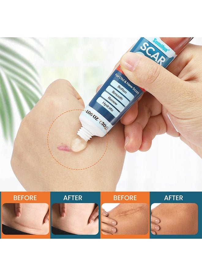 Sumifun - Scar Gel - Scar Removal Cream for Damaged Skin Dead Skin Elimination New & Old Scars Removal Gel Repair Face and Body Skin Repair Gel Unisex 30g - Image 1