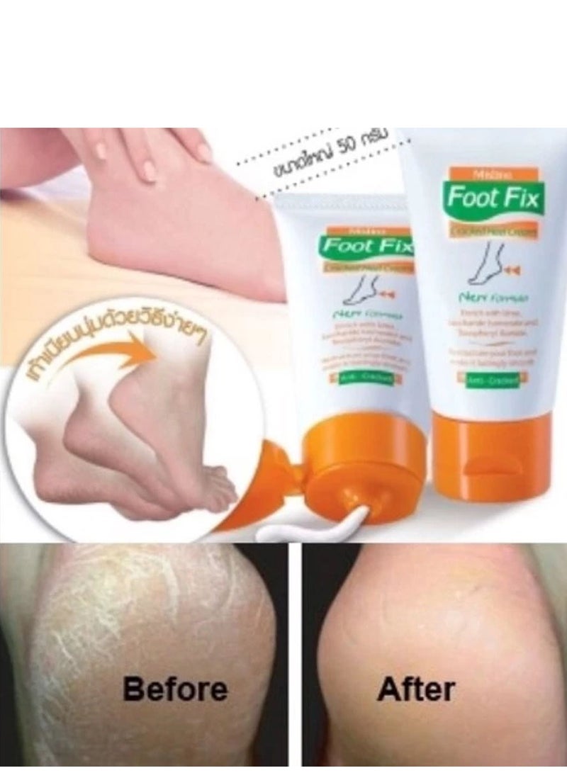 ميستين كريم فوت فيكس لعلاج تشققات الكعب علاج مرطب للأقدام الجافة والخشنة، كريم مضاد للفطريات للقدم مع مبرد مرفق  60 غرام - Image 3