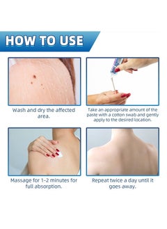 Jaysuing Skin Tag Wart Removal Ointment  - Wart Remover Ointment Maximum Strength - Plantar Warts - Natural Safe And Easy To Use - 20G  - Image 5