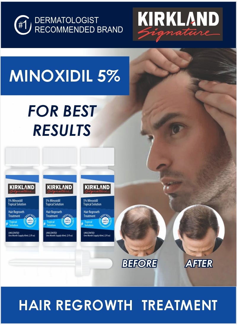 Kirkland Signature - Minoxidil 5% Hair Loss Solution for Men – 3-Month Pack for Thicker Hair - Image 1