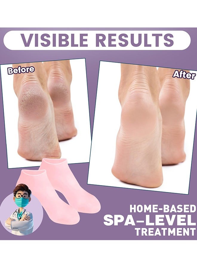 Generic - 2 Pairs Women Foot Spa Pedicure Silicone Socks - Anti Slip Aloe Socks, Calluses, Spa Gel Socks Foot Care After Pedicure, for Dry Cracked Feet Women - Image 1