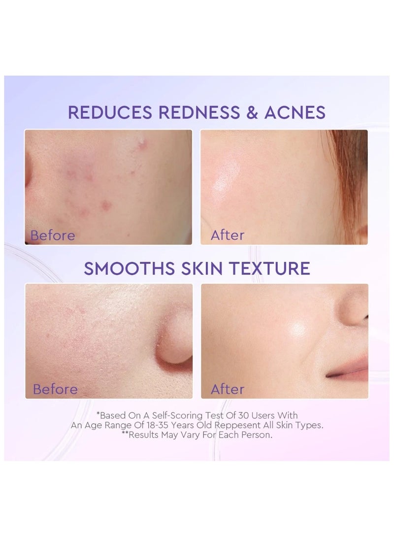 Glad2Glow Complete Glad2Glow Set: AHA BHA PHA Intensive Peeling Solution Serum 15ml with Blueberry Ceramide Moisturizer 30g - For Glowing Skin, Acne Treatment, and Skin Barrier Repair - Image 5