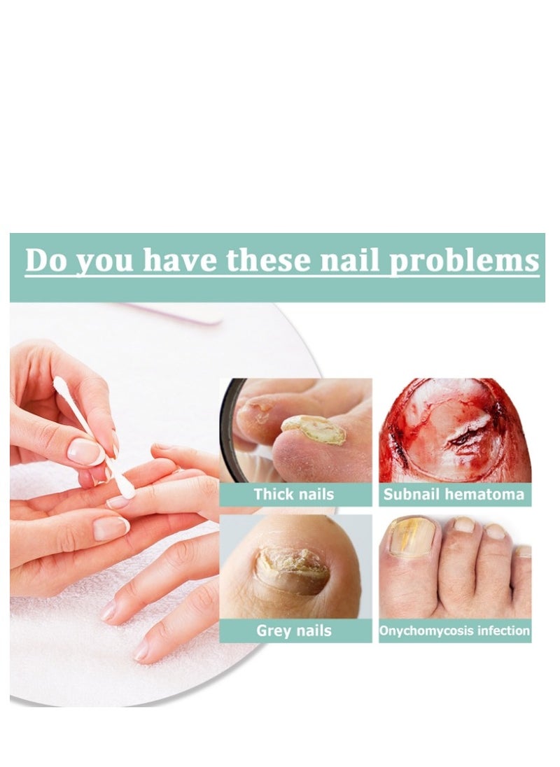 SOUTH MOON Nail Care Pen Moisturize Strengthen Radiant Nails Fingernail Edge Manicures Nourishing Pen Cuticle Oil Nail Strengthener Prevent  Treat Nails Healthy Nail Pen Oil  - Image 4