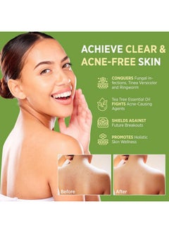 Roycederm Roycederm Antifungal Antibacterial Tea Tree Soap: Antifungal Antibacterial Treatment for Face & Body Acne, Athlete's Foot, Tinea, Folliculitis Ringworm Jock Itch (Pack of 1)  - Image 3