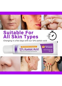 Azelaic Acid Serum, Azelaic Acid 12% Cream，Hyaluronic Acid and Niacinamide, Relieves Redness, Dark Spots, Rosacea, Balances Excess Sebum, Brightening Face Skin Care Treatment for All Skin Types 20g - pzsku/ZE86EC1BFB290F2245546Z/45/_/1739785762/2ca2a940-ed02-42d8-833b-9899852383c8