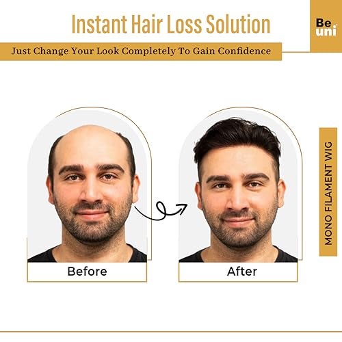 Beuni Smart Hair Patch For Men Monofilament Apollo Mono Wig With 100 Percent Natural Human Hair Long Lasting Soft Fit Base Natural Black 9x7 Inch - Image 3