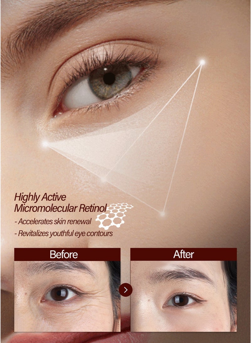 LYDIMOON Retinol Eye Serum, Fade Fine Lines, Firm & Moisturize Repair 30ml - Image 4