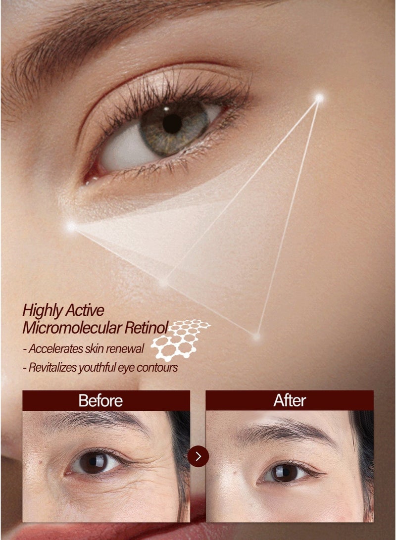 LYDIMOON Retinol Eye Essence Serum Deep Hydrating Anti‑Wrinkle Firming Eye Care for Fine Lines Crow’s Feet & Dull Skin - Image 5