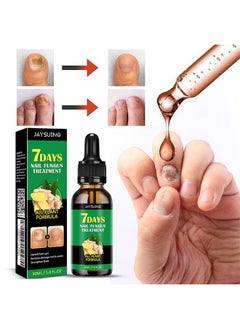 7days Nail Fungus Treatment for Nail Care Onychomycosis Repair and Moisturizing, Nail Nutrient Oil Strengthener Oil Serum Ginger Nail Growth Oil 30ml - pzsku/ZE89B56625C233CBF8EC5Z/45/_/1730191700/13fd39d3-07c3-4210-9a89-c8c22576a559