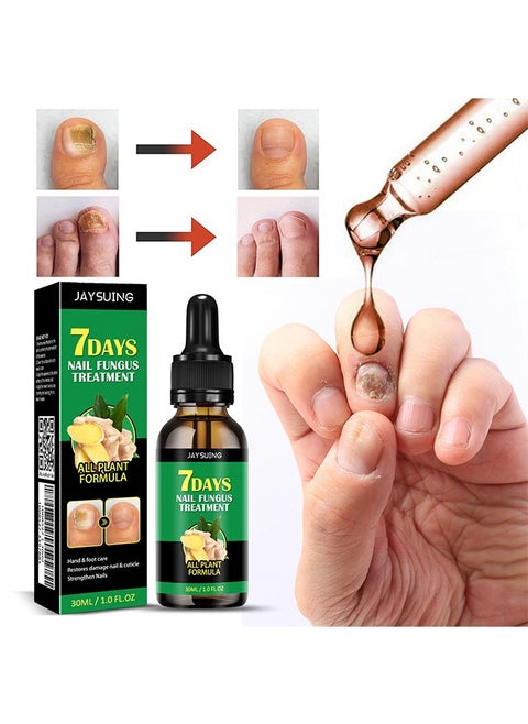 7days Nail Fungus Treatment for Nail Care Onychomycosis Repair and Moisturizing, Nail Nutrient Oil Strengthener Oil Serum Ginger Nail Growth Oil 30ml