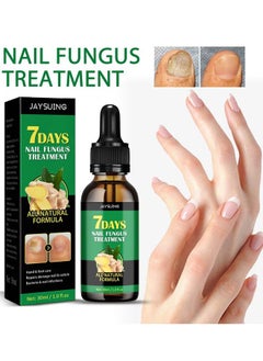 7days Nail Fungus Treatment for Nail Care Onychomycosis Repair and Moisturizing, Nail Nutrient Oil Strengthener Oil Serum Ginger Nail Growth Oil 30ml - pzsku/ZE89B56625C233CBF8EC5Z/45/_/1730191700/cbdd4a87-5114-45df-b39a-a2c089932dfa