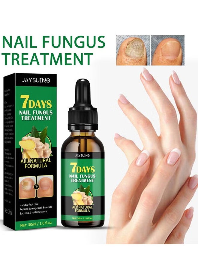 7days Nail Fungus Treatment for Nail Care Onychomycosis Repair and Moisturizing, Nail Nutrient Oil Strengthener Oil Serum Ginger Nail Growth Oil 30ml