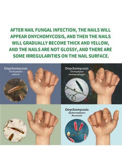 7days Nail Fungus Treatment for Nail Care Onychomycosis Repair and Moisturizing, Nail Nutrient Oil Strengthener Oil Serum Ginger Nail Growth Oil 30ml - pzsku/ZE89B56625C233CBF8EC5Z/45/_/1730191711/8819cb4e-aea5-4b2c-964d-b6594597d058